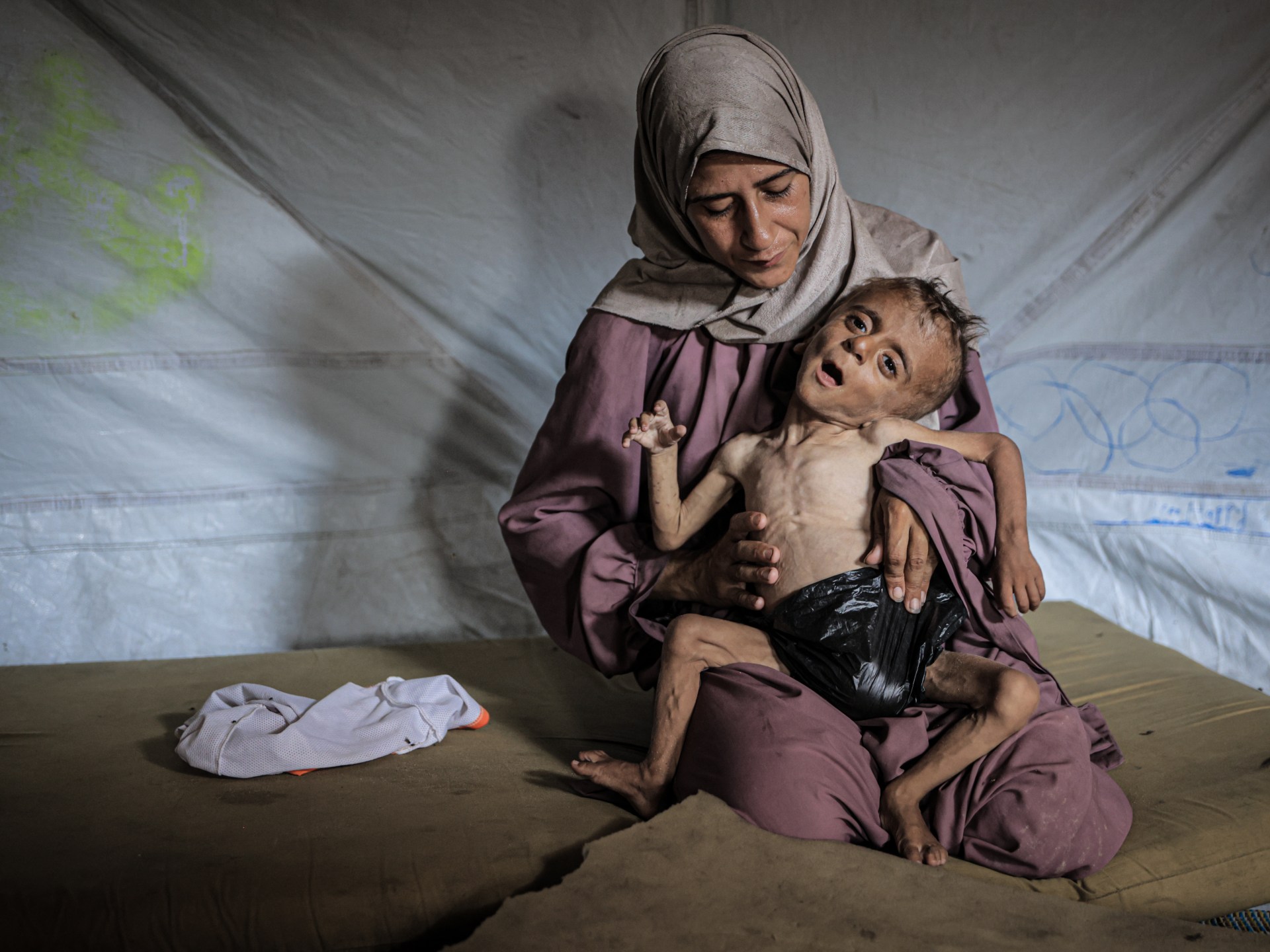 Pictures .. Hunger kills the children of Gaza and the world is speaking