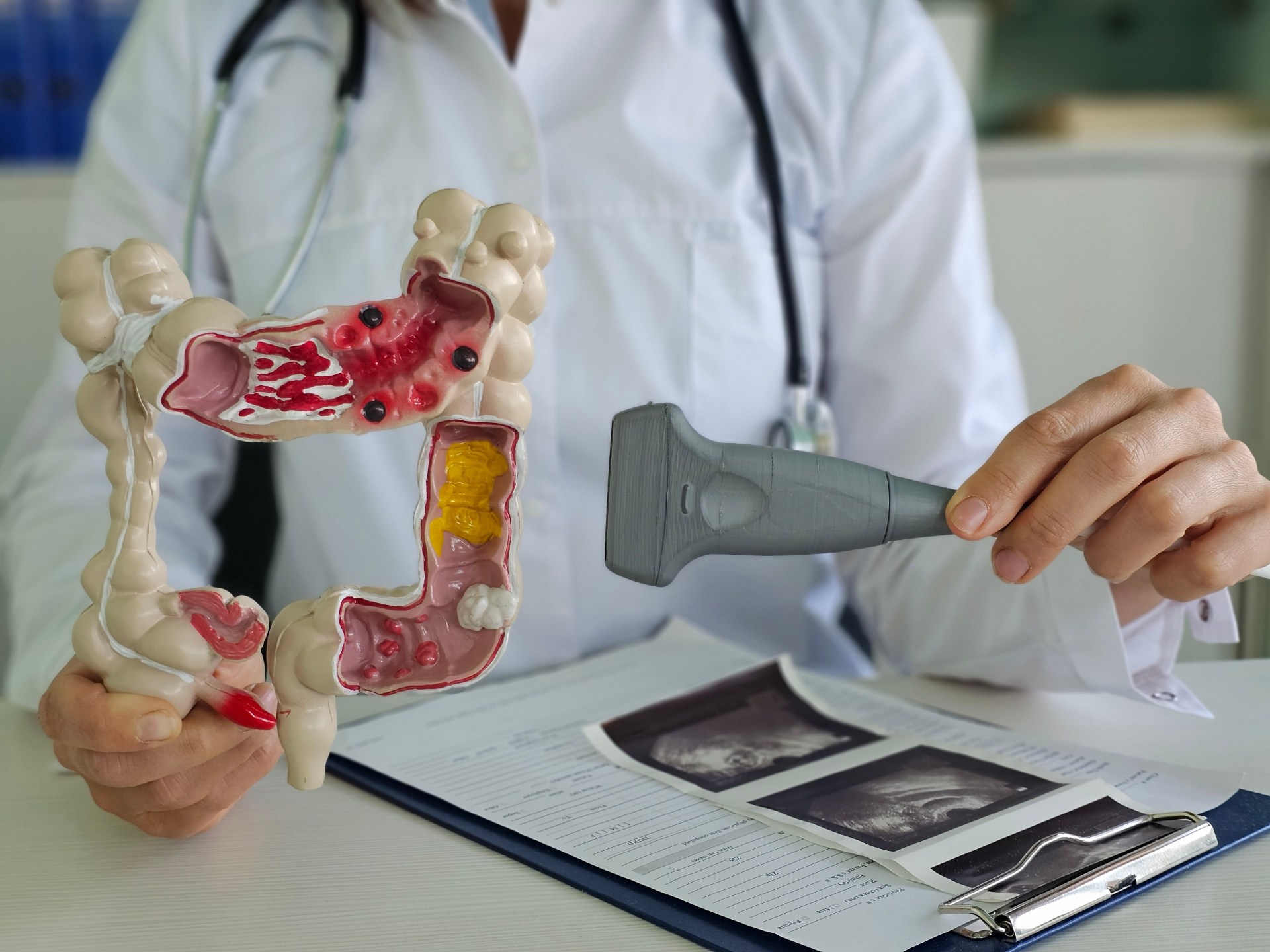 Ultrasound gives hope with accurate cancer treatments