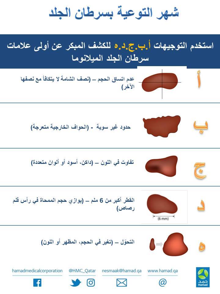 Skin cancer symptoms and source information, Hamad Medical Corporation in Qatar