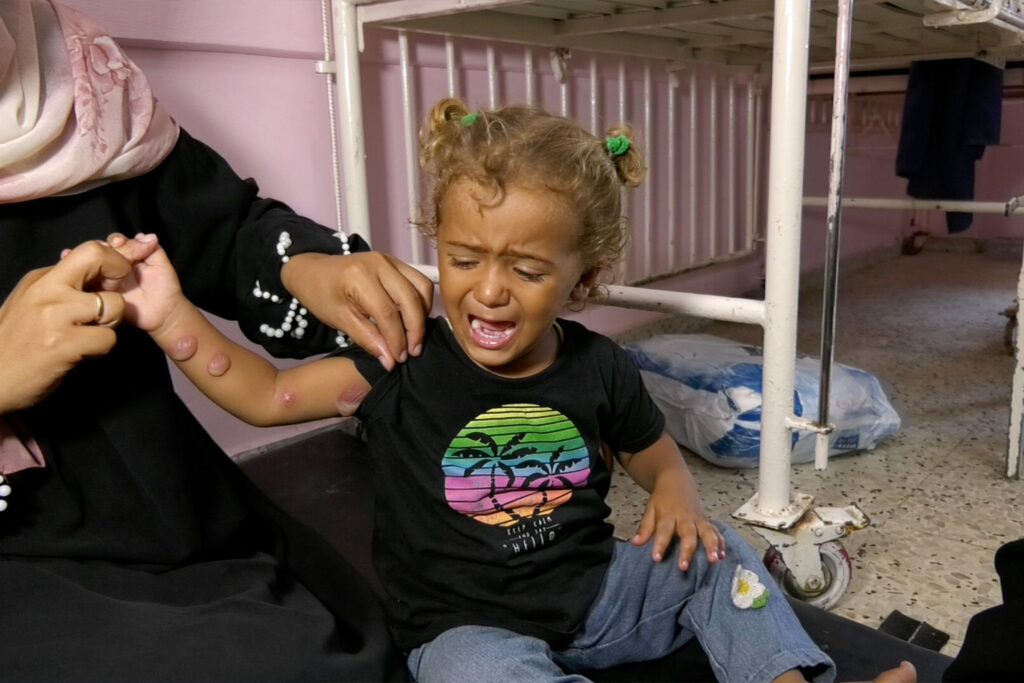 The rash raises the bodies of the Gazans and empty pharmacies of each medicine