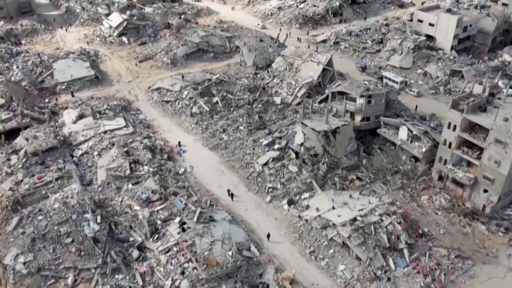 Gaza Health: Israeli starvation causes the death of 8 people with syndrome "Ghilan Barre"