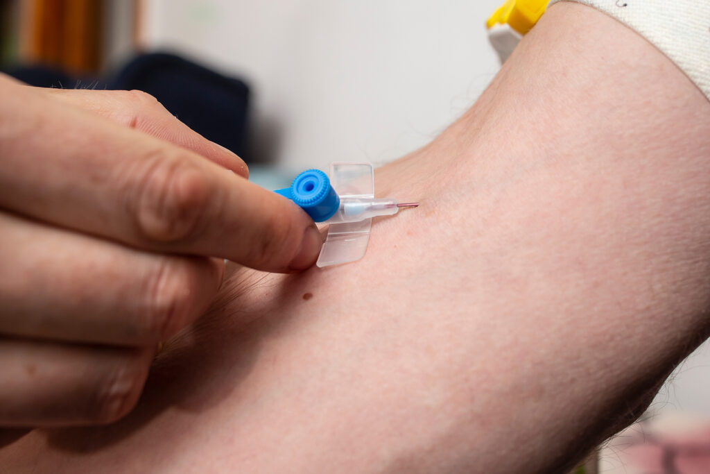 New technology to accelerate slow venous injection