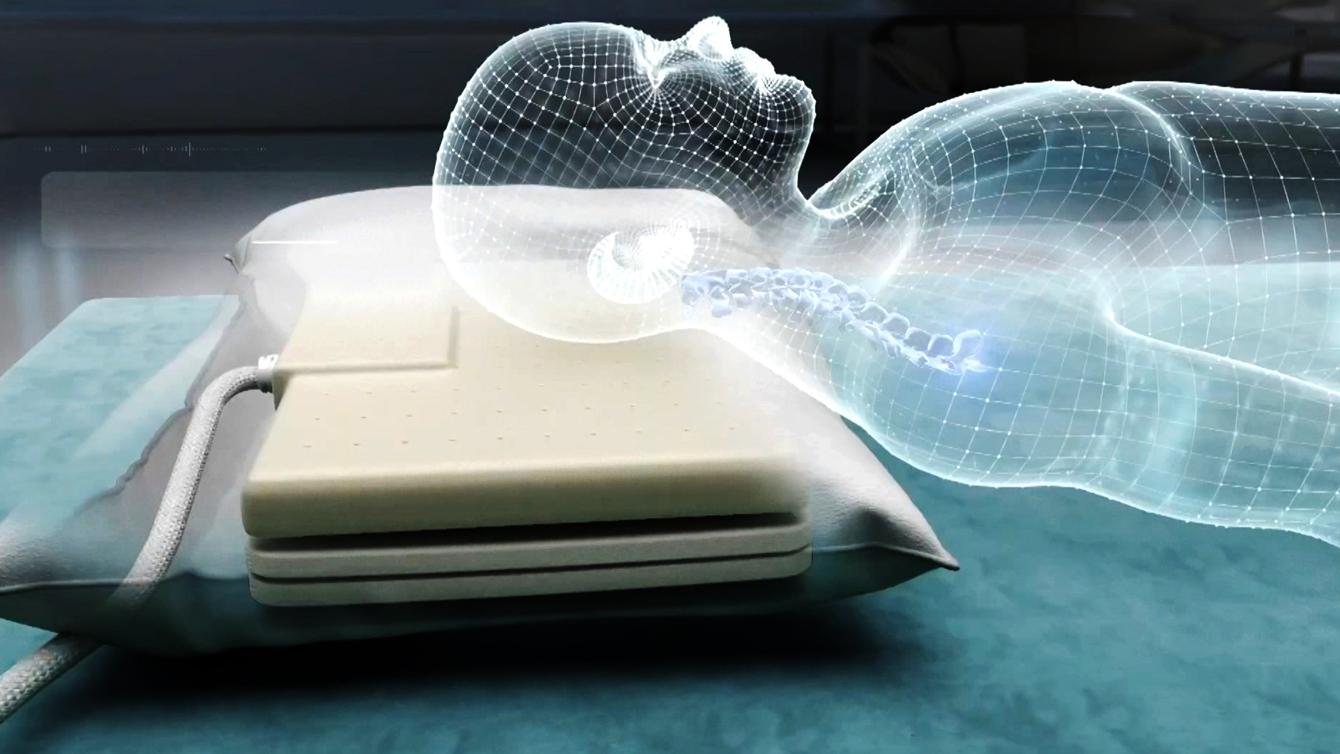 Sleep patterns disorder in heart failure patients double the risk of relapses