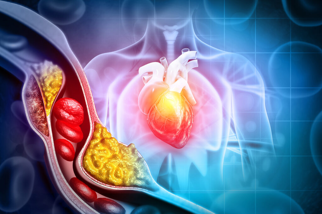 Various results for two studies about common pills that patients take after a heart attack