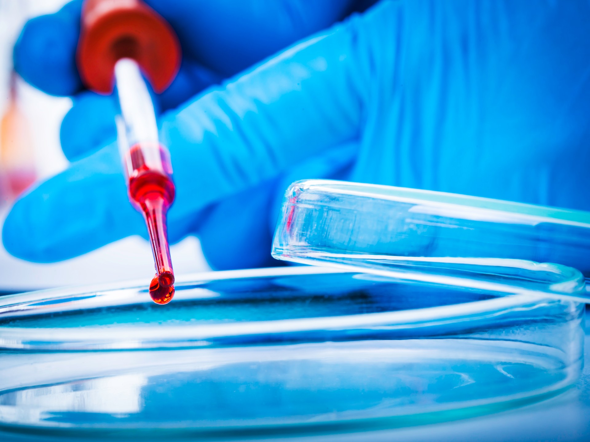 A new blood test that foreshadows cancer 10 years before the symptoms appear