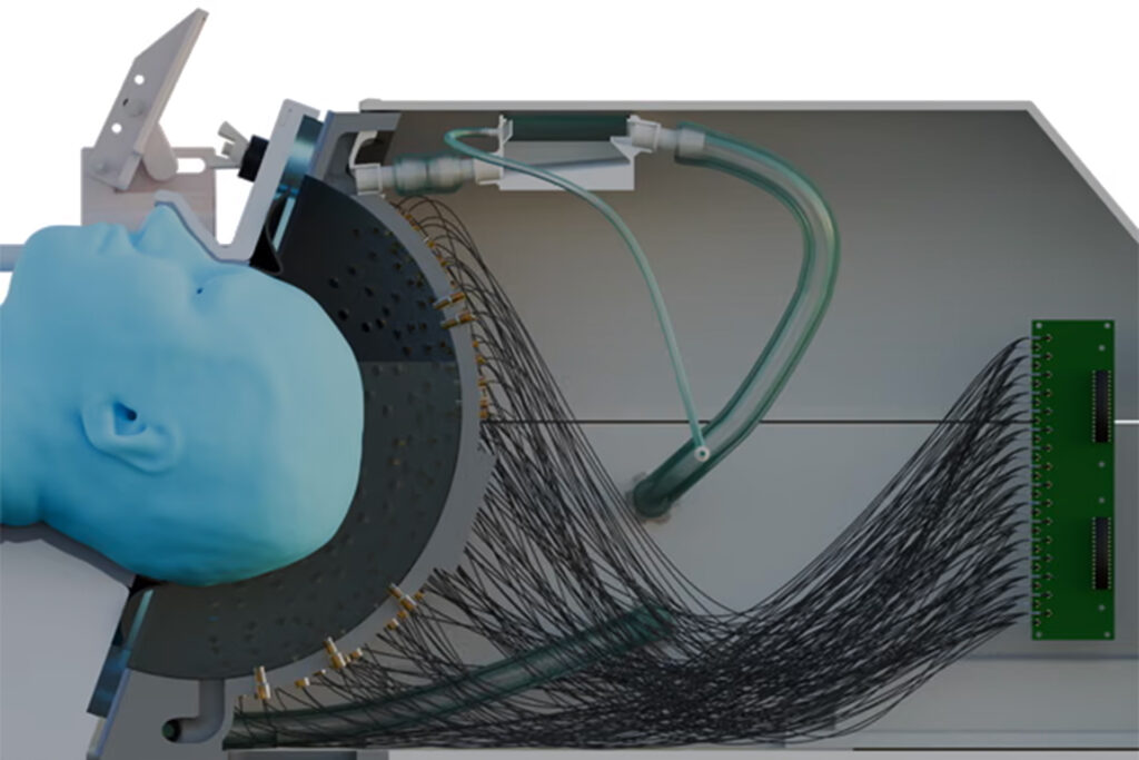 A new device opens horizons for the treatment of Parkinson's without surgery