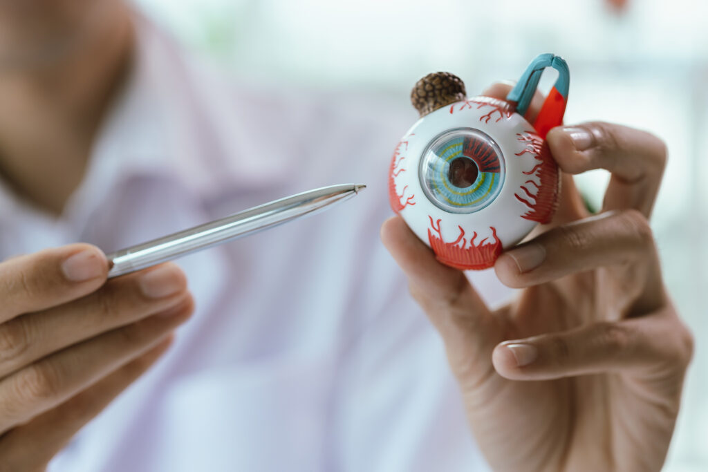 Artificial intelligence determines the patients of the cornea who need a cornea plant