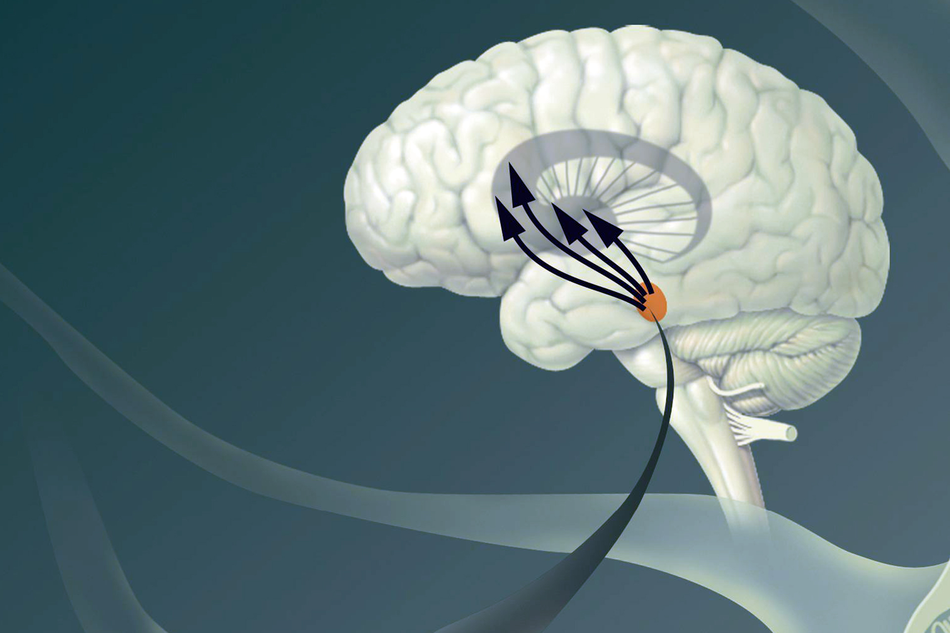 Delivery of medications to the brain to the opening of the blood septum