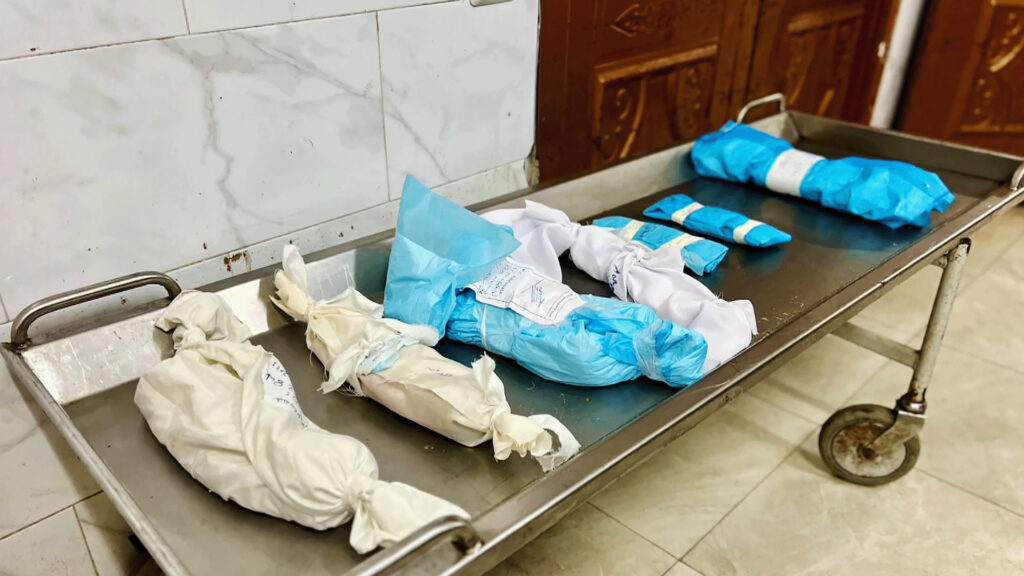 Gaza .. Children wet starvation and illness due to the Israeli genocide