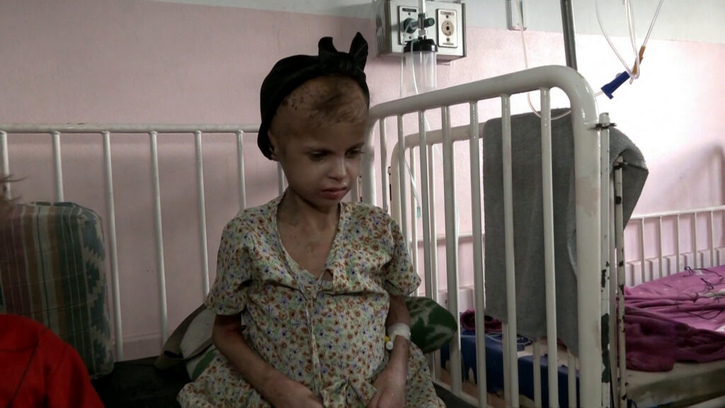 UNICEF: Gaza children need more nutrition and health services for life