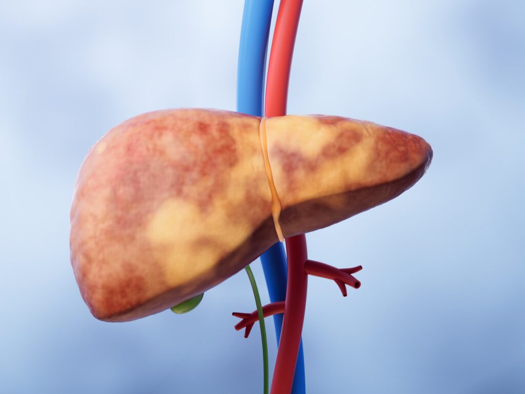 A breakthrough in the treatment of liver diseases using two common drugs