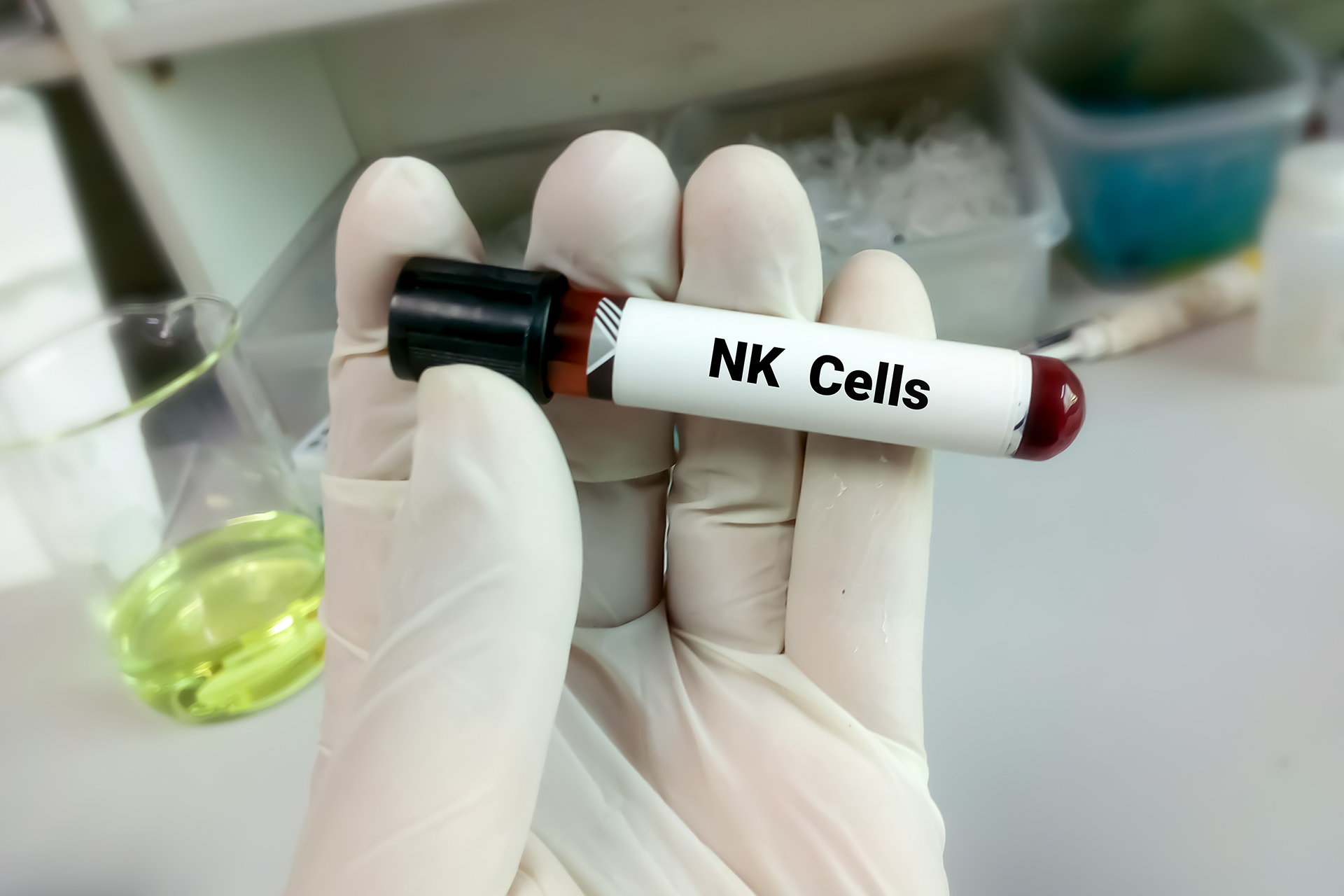 Genetically modified natural killer cells...a new weapon against cancer