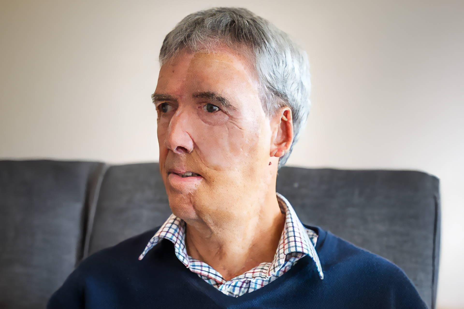 3D printing restores facial features to a British man