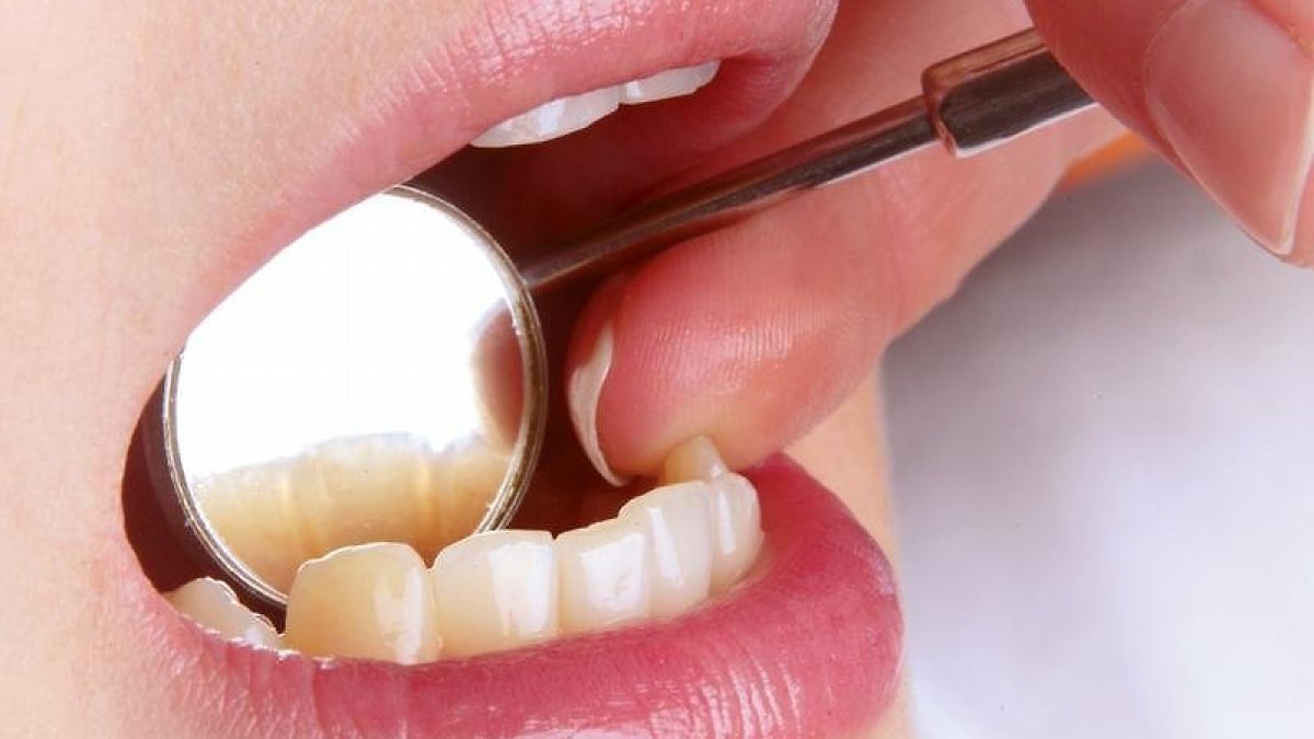 What causes toothache when you have a cold?