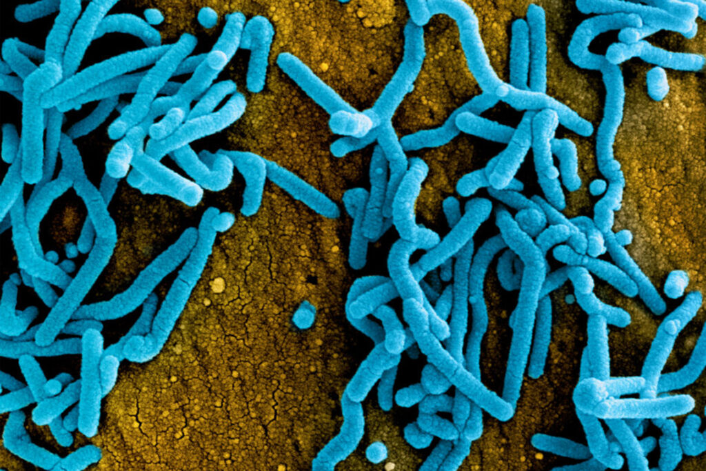 Deaths due to Marburg virus in Ethiopia rise to 6