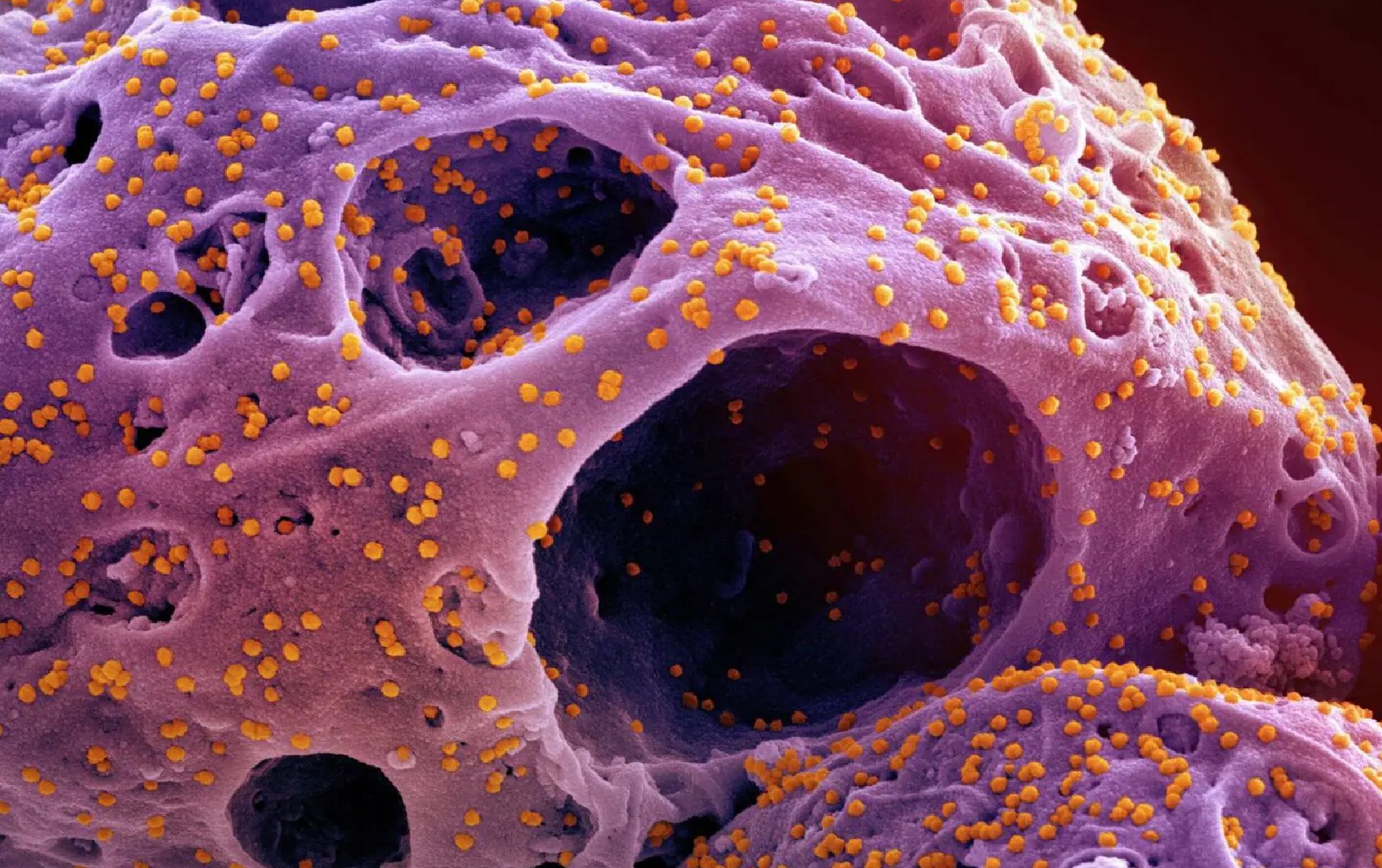 Document: America links health aid to obtaining data on pathogens