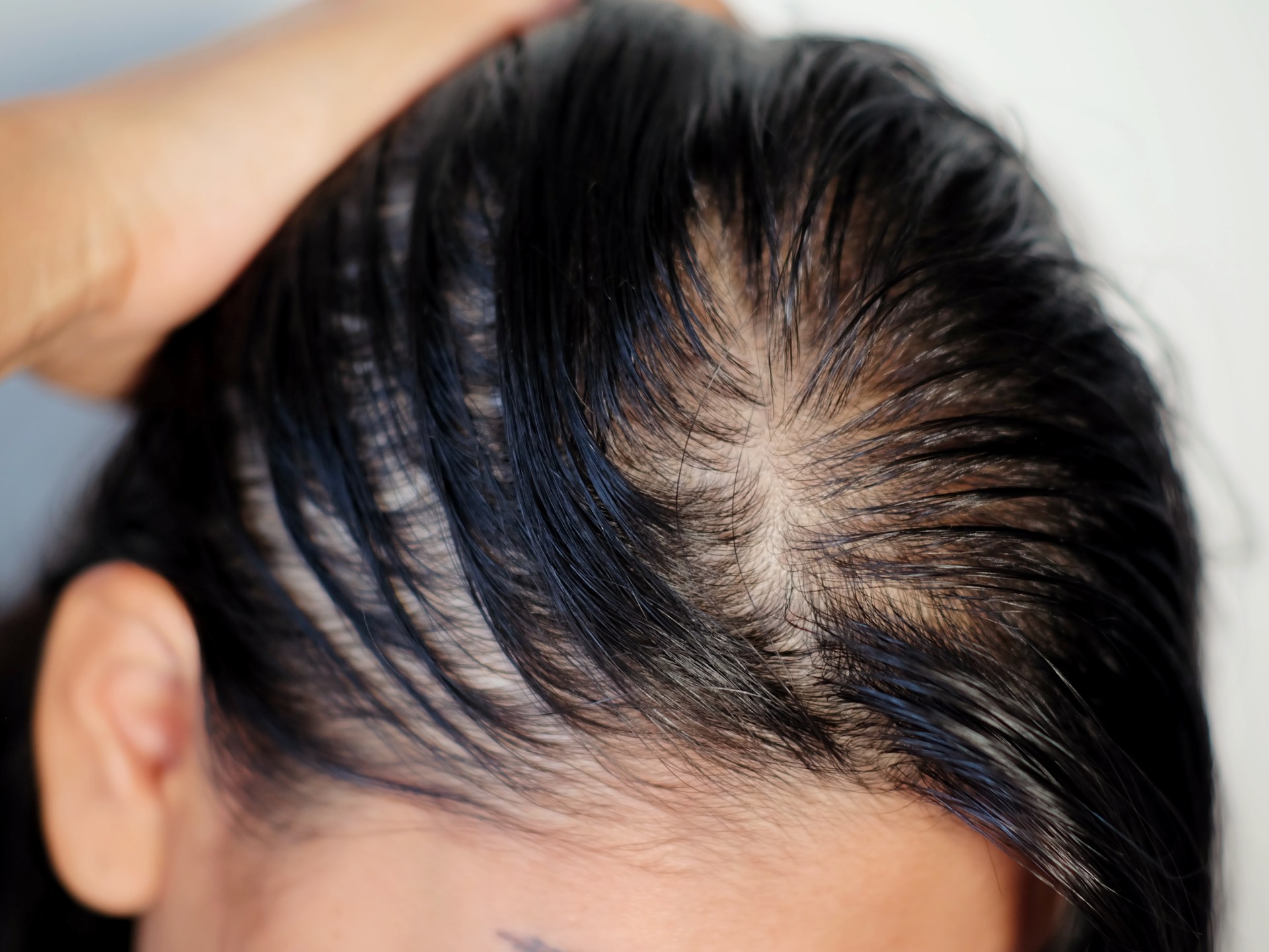 How do you take care of the health of dry hair?