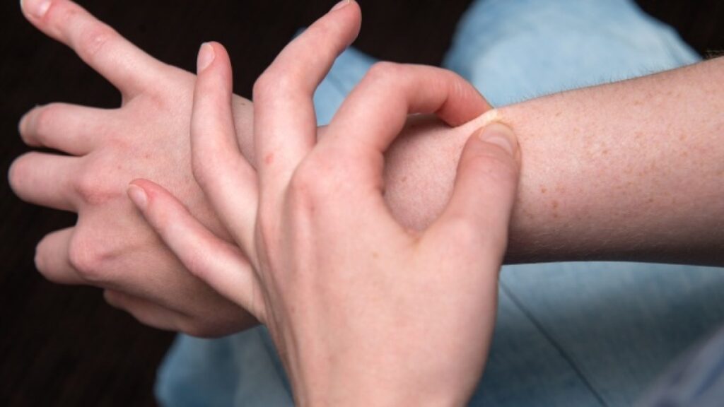 How to properly care for scars