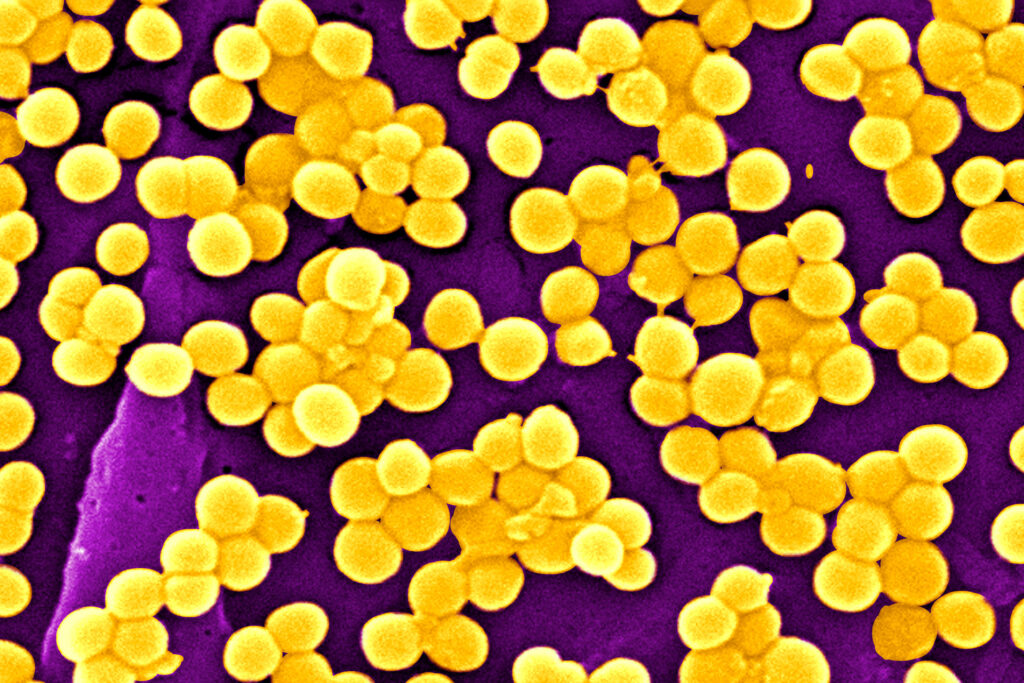 Study: Viruses may help treat deadly Staphylococcus aureus infections
