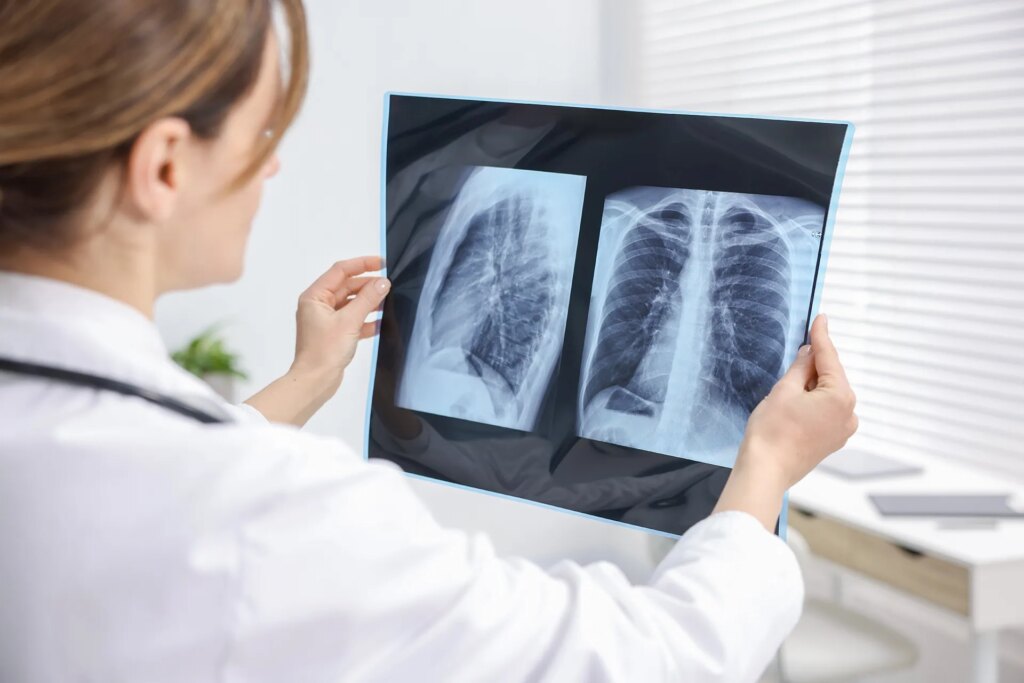 Scientific secrets that explain why women are more affected by lung diseases than men