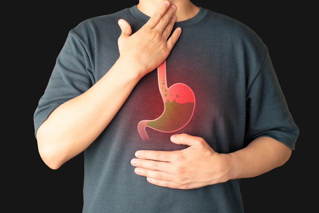 Cambridge resolves the controversy: Barrett's esophagus is the hidden beginning of cancer
