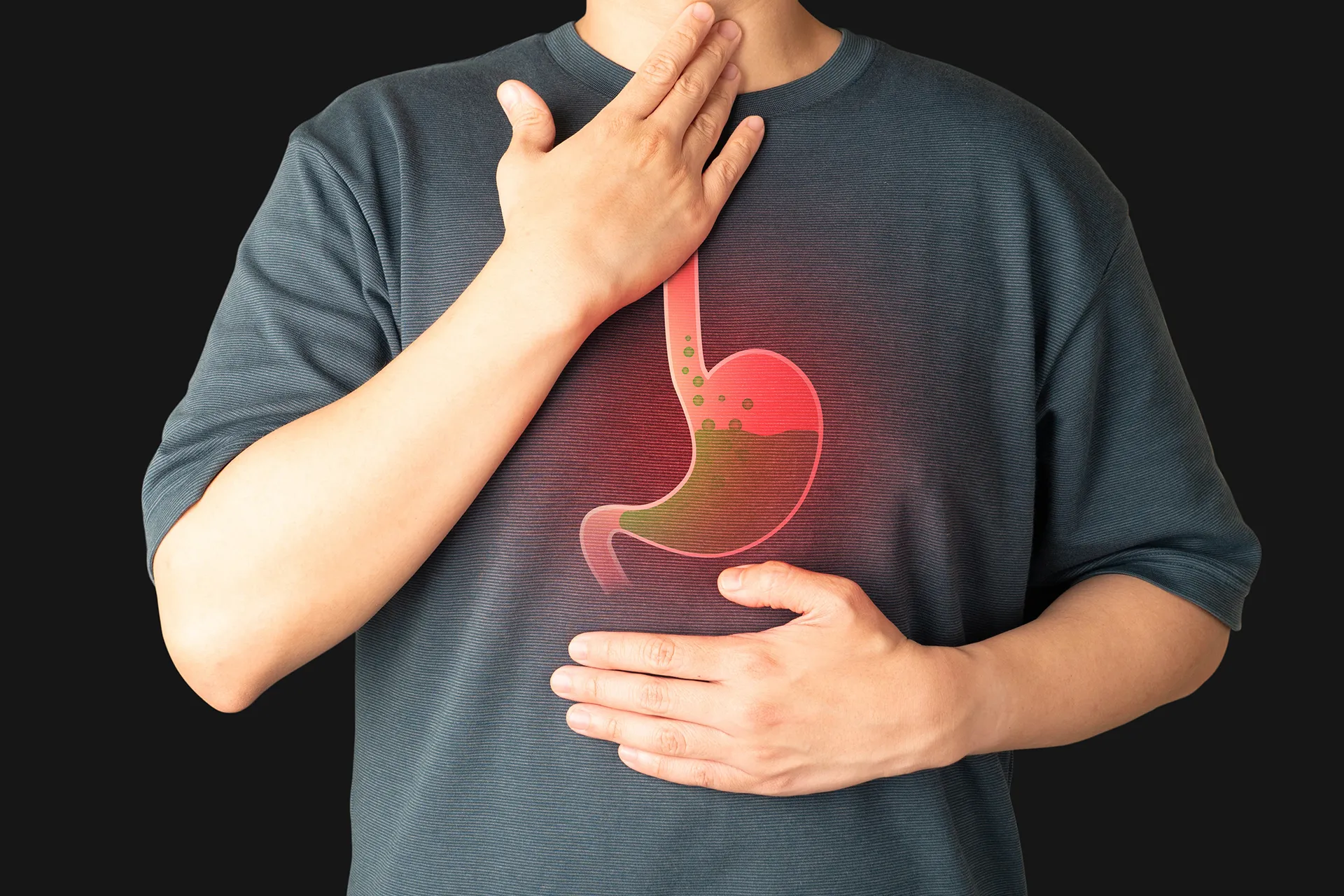 Cambridge resolves the controversy: Barrett's esophagus is the hidden beginning of cancer