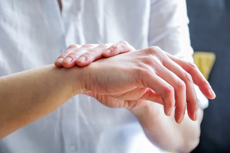 Female hands, close up, skin condition, eczema