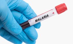 Who protects rural Zimbabwe from malaria after America abandoned it and was besieged by rain?