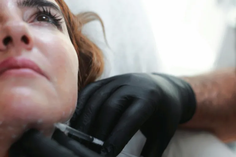 Close-up of a woman receiving dermal filler injection by a professional in black gloves.