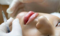 Hyaluronic acid injections for the face…a secret to freshness or a cosmetic exaggeration?