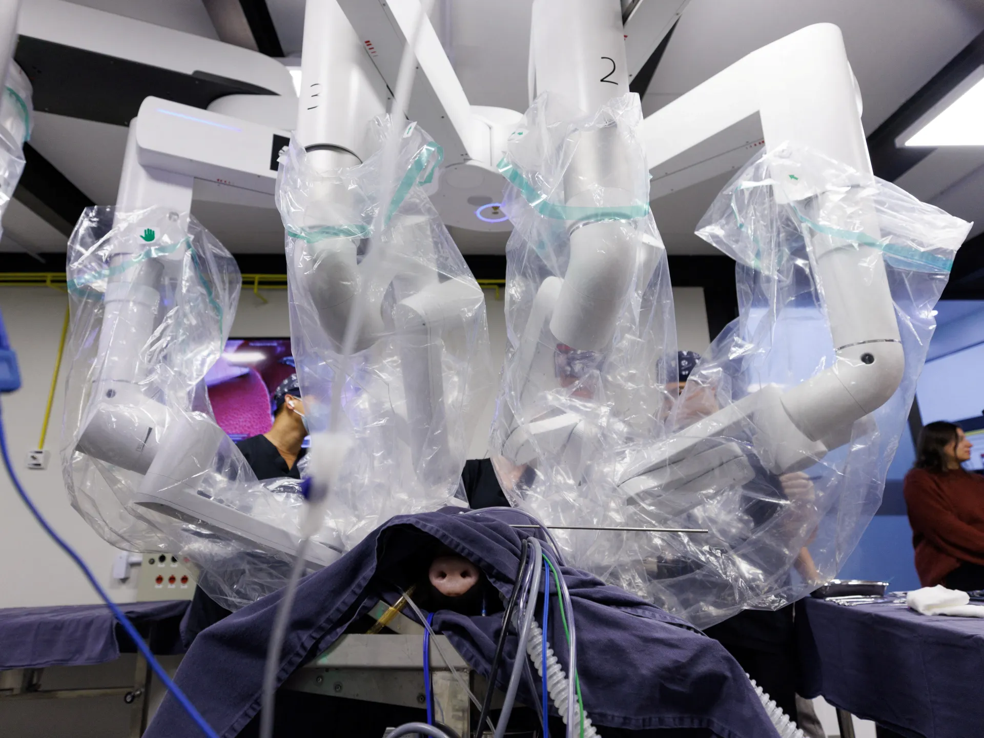 After its spread...Does remote robotic surgery succeed in critical situations?