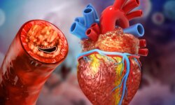 Cholesterol medications…the medical truth behind the most disturbing treatments