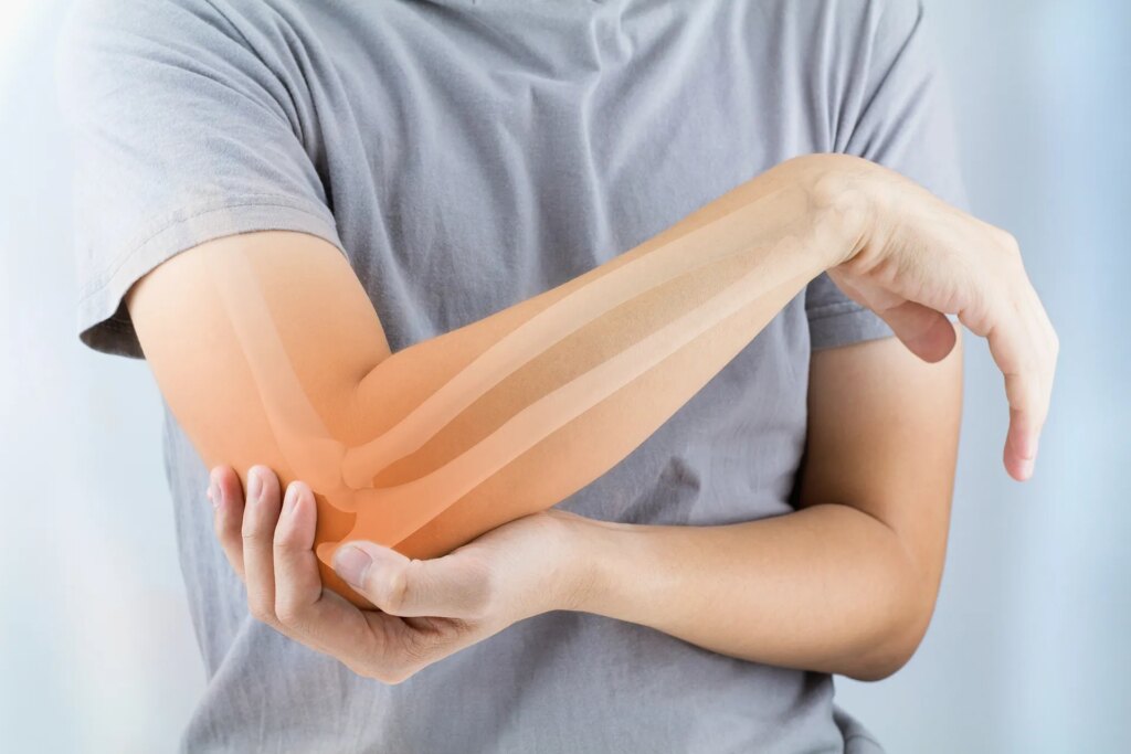 It's not just calcium...bone secrets that no one tells you