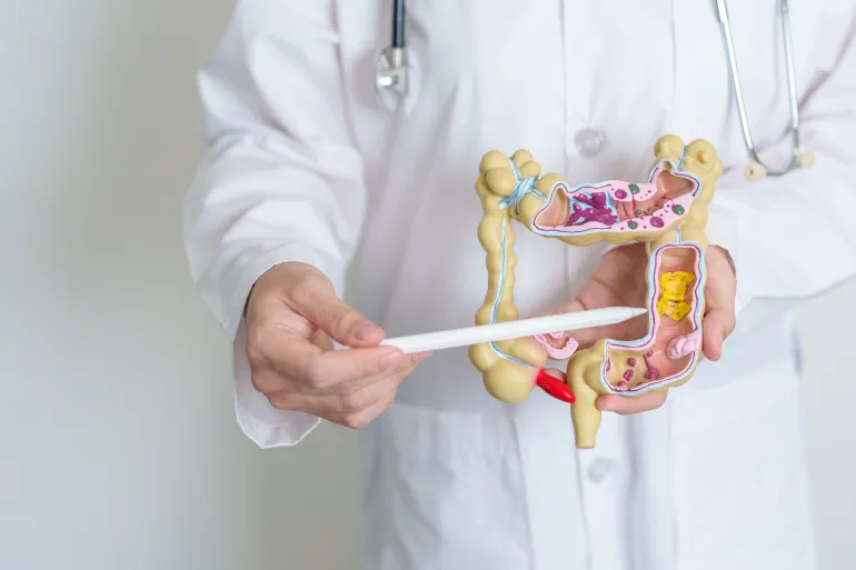 Doctor holding human colon anatomy model. Colonic disease, Large Intestine, Colorectal cancer, Ulcerative colitis, Diverticulitis, Irritable bowel syndrome, Digestive system and Health concept