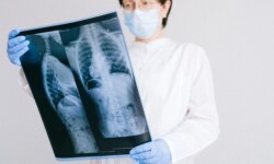 The lungs…behind every breath is life