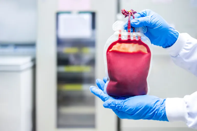 Leukocyte poor pack red cell in transfusion bag on a tray inside blood bank.Blank or empty space no label.Blood prepares for donation or treatment of anemia patients in hospital.Plastic bags with hand.