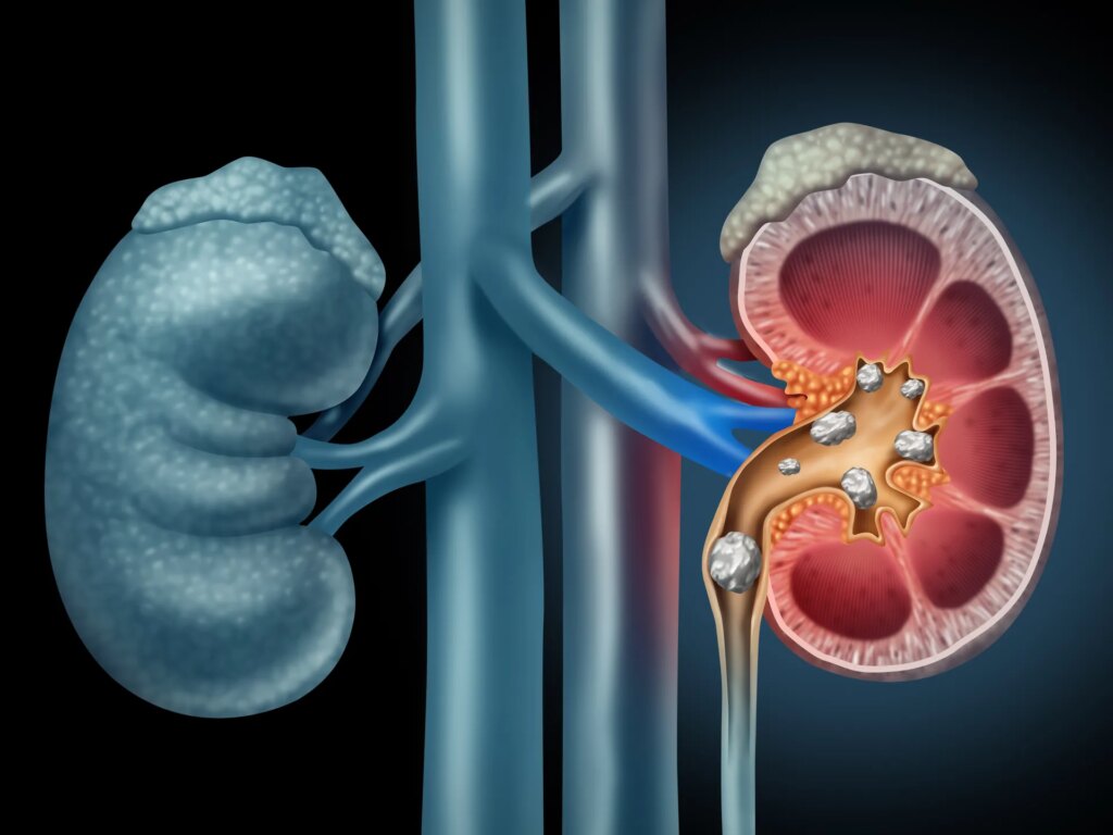 The kidneys...an engineering masterpiece in the human body