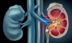 The kidneys…an engineering masterpiece in the human body