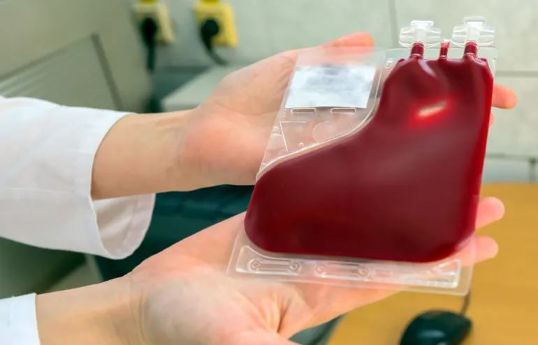 Placental cord blood bank donated blood unit prepared by isolated gloved hands. Source: Adobe Stock