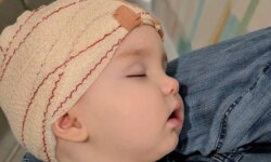 Springs inside a child’s skull…a global precedent that reshapes his head