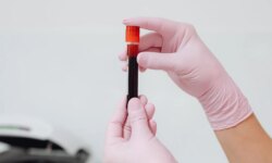 What’s running through your veins? Secrets of blood and the most prominent diseases that threaten it
