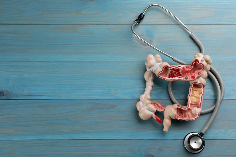 Human colon model and stethoscope on light blue wooden table, flat lay. Space for text Source: AdobeStock