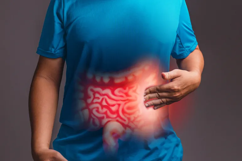 About 20% of early cases are associated with hereditary cancer syndromes, while the genetic cause is not known for the majority