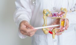 The mystery of colon cancer in young people: threads that lead to childhood and the intestines