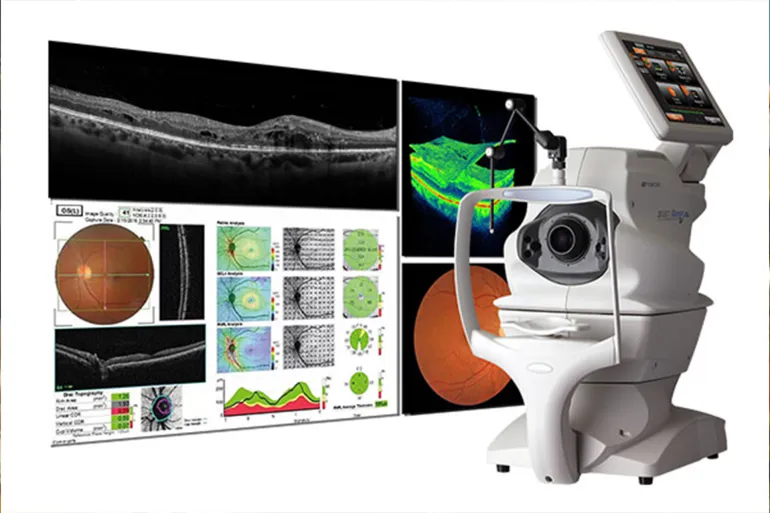 OCT technology combines physics, engineering and medicine to deliver high-resolution images of living tissue