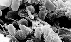 The plague returns to the forefront… suspicions about Russia covering up a fatal accident in a laboratory