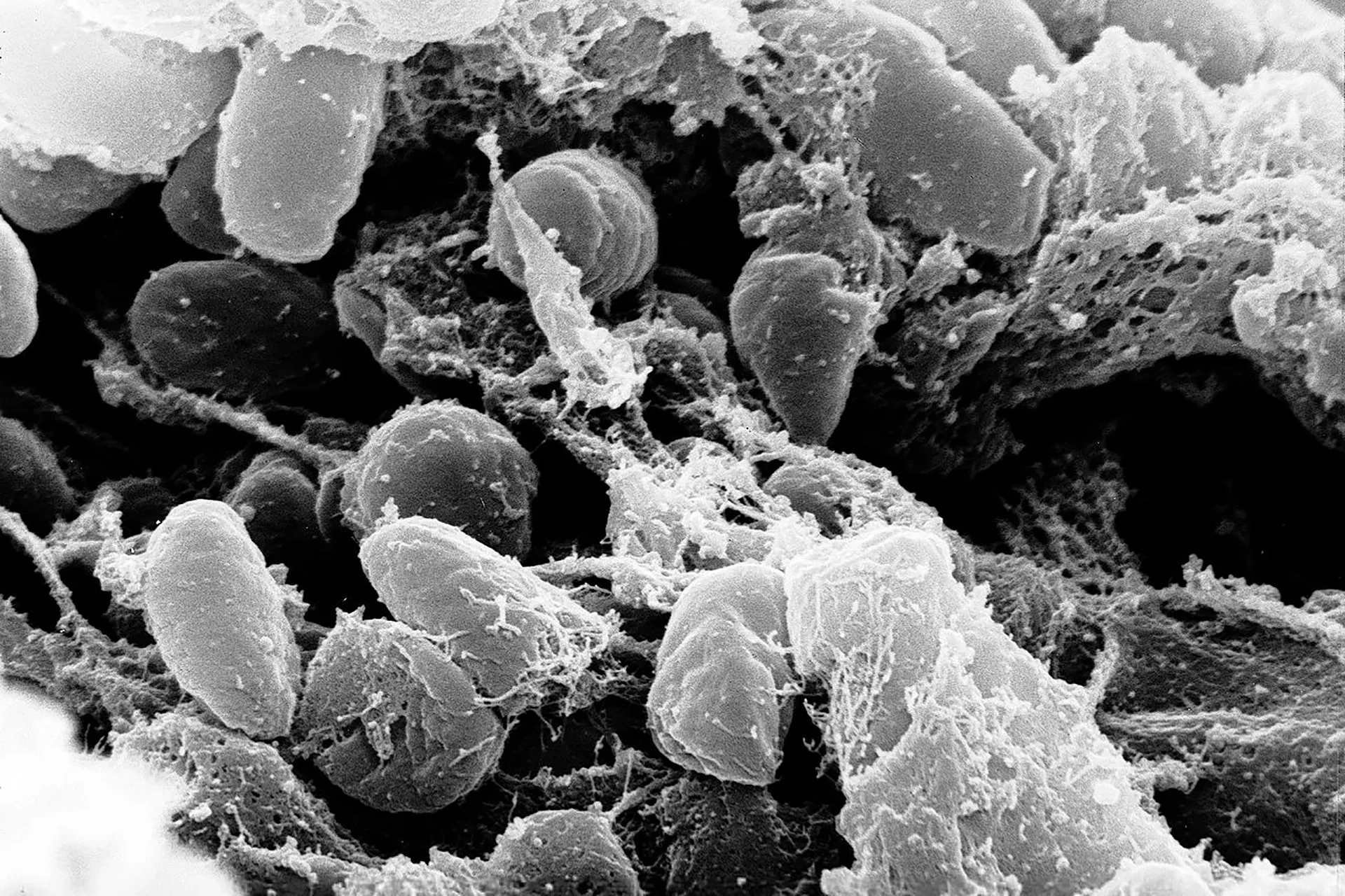The plague returns to the forefront... suspicions about Russia covering up a fatal accident in a laboratory