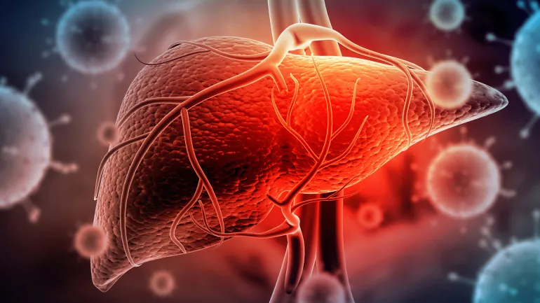 Chronic hepatitis B infection can cause persistent inflammation and damage to liver tissue