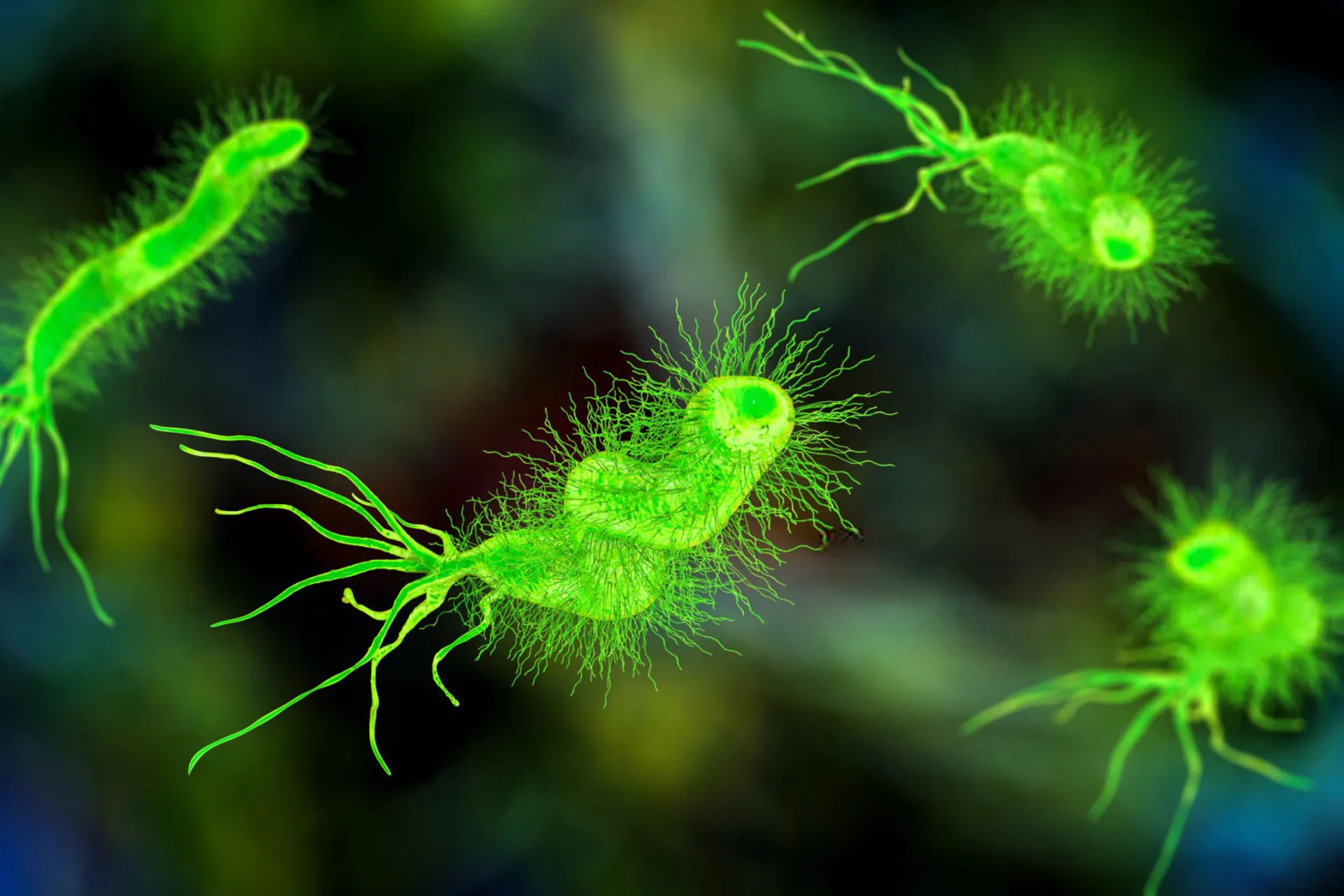 Infection may also lead to cancer.. 5 causes at the forefront