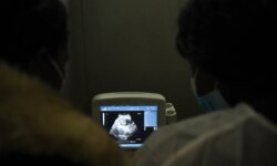A fetus in the stomach of an Egyptian girl… Bleeding leads to an extremely rare medical condition